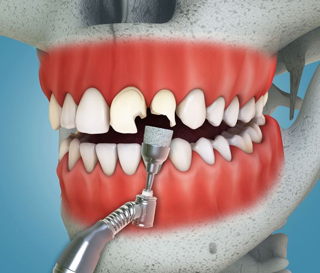 Un gruppo di dentisti sta lavorando su un paziente in una sala operatoria