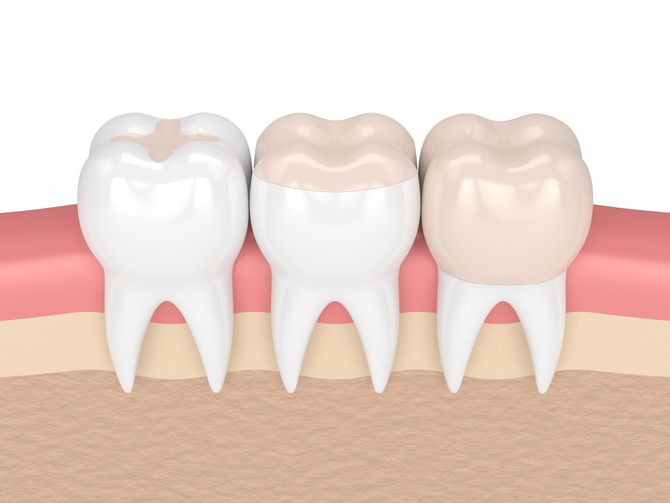 Un gruppo di dentisti sta lavorando su un paziente in una sala operatoria
