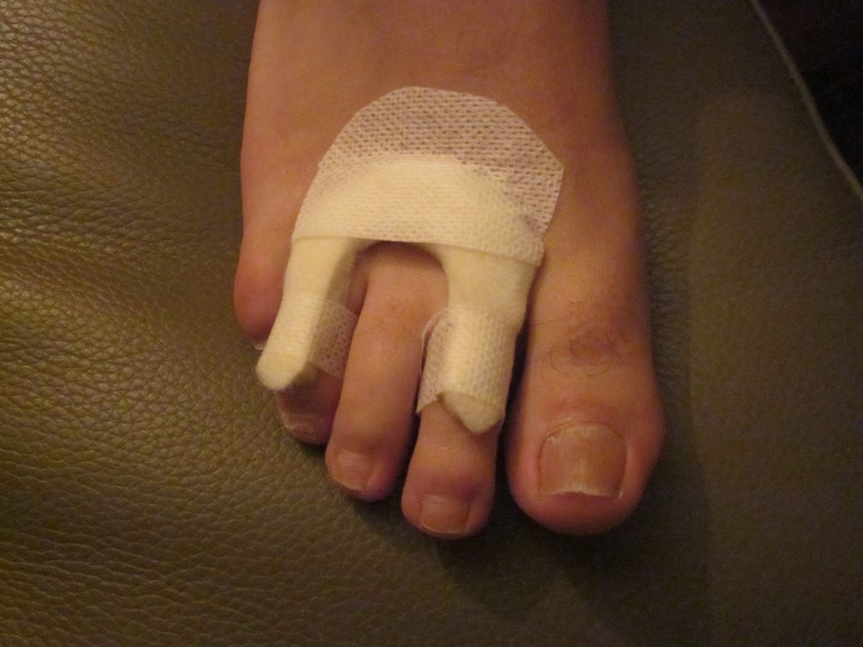 Voet met verband om de middelste teen.