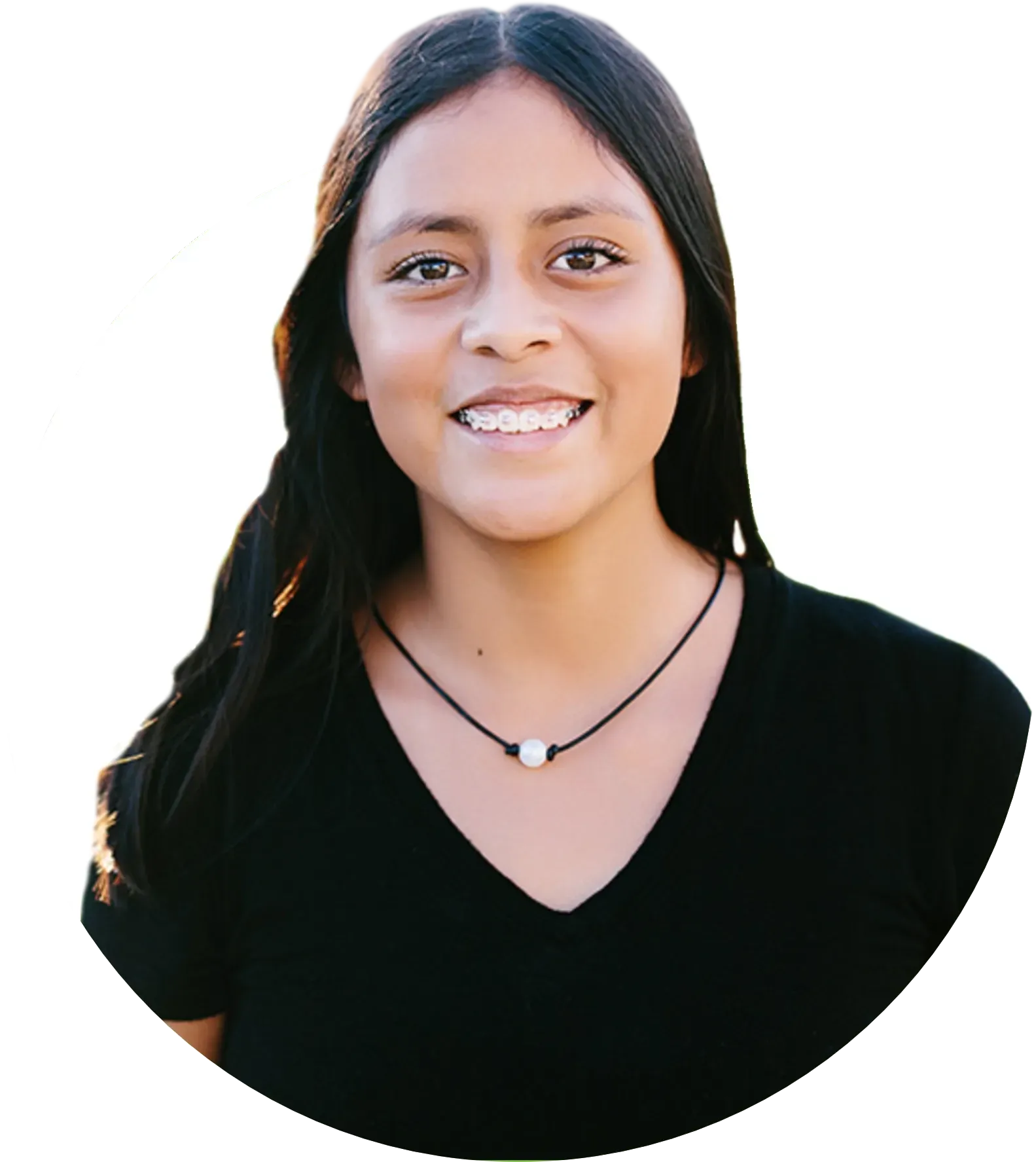 a teen girl with braces on her teeth