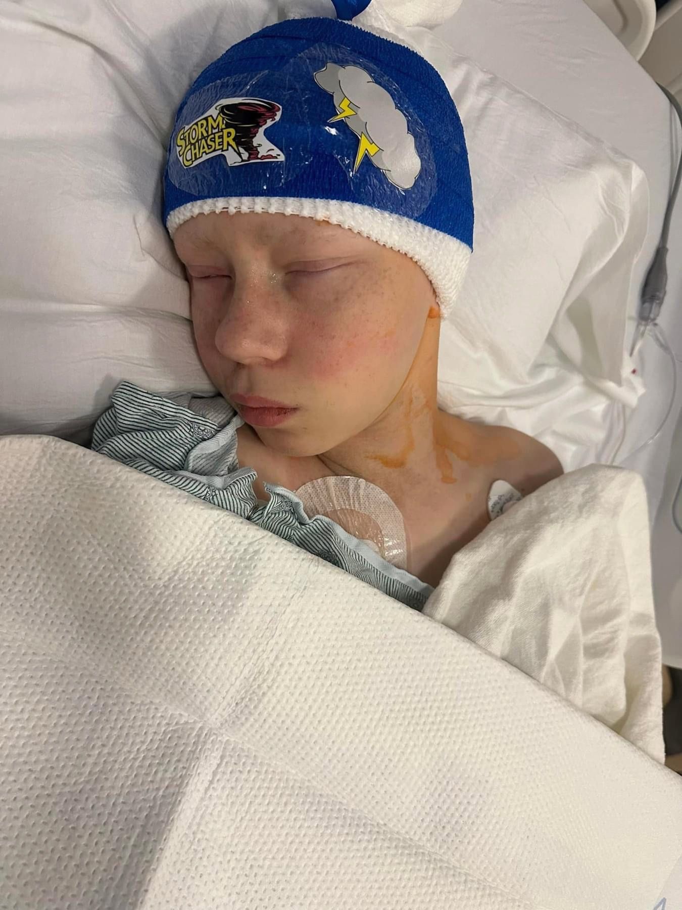 A person sleeping in a hospital bed wearing a blue patterned beanie and a hospital gown with medical patches on their chest.