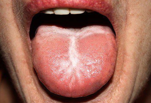 Der er en tendens Proportional form What does your tongue say about your health?