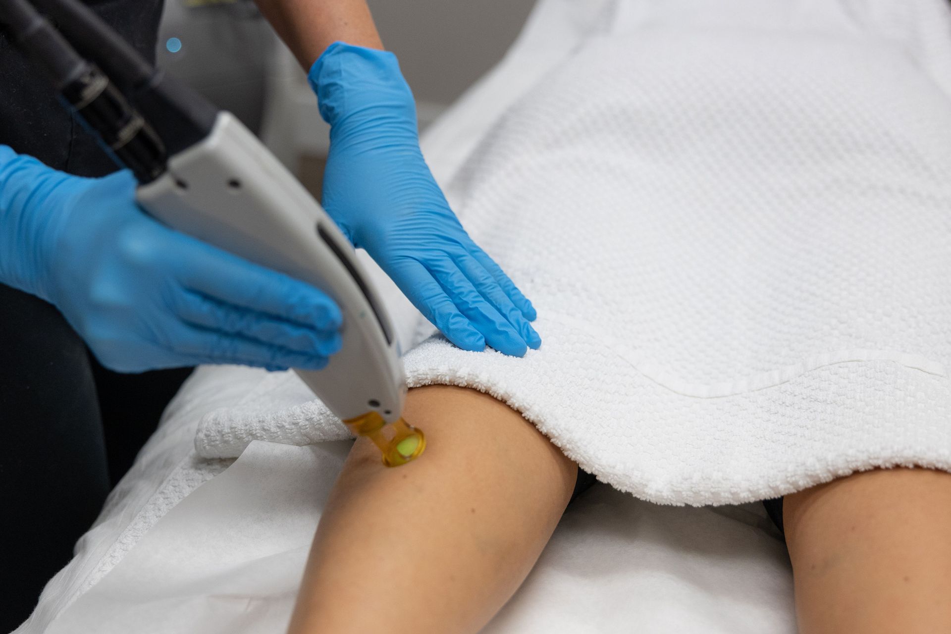 A woman is getting a laser hair removal treatment on her leg.