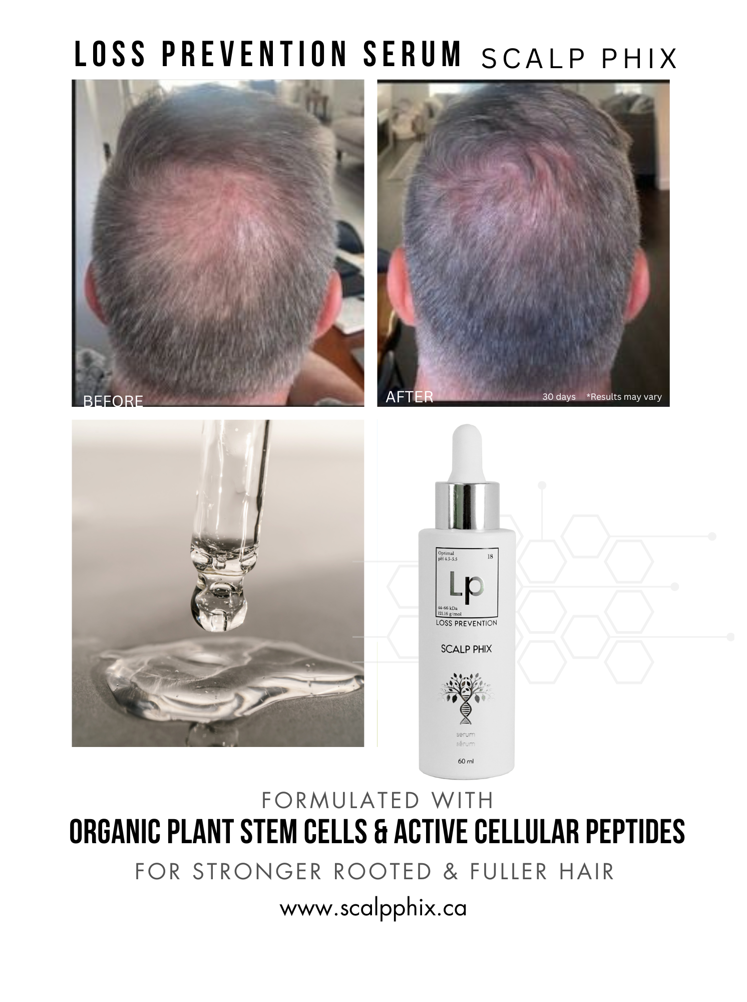 A bottle of loss prevention serum with organic plant stem cells and active cellular peptides for stronger rooted and fuller hair.