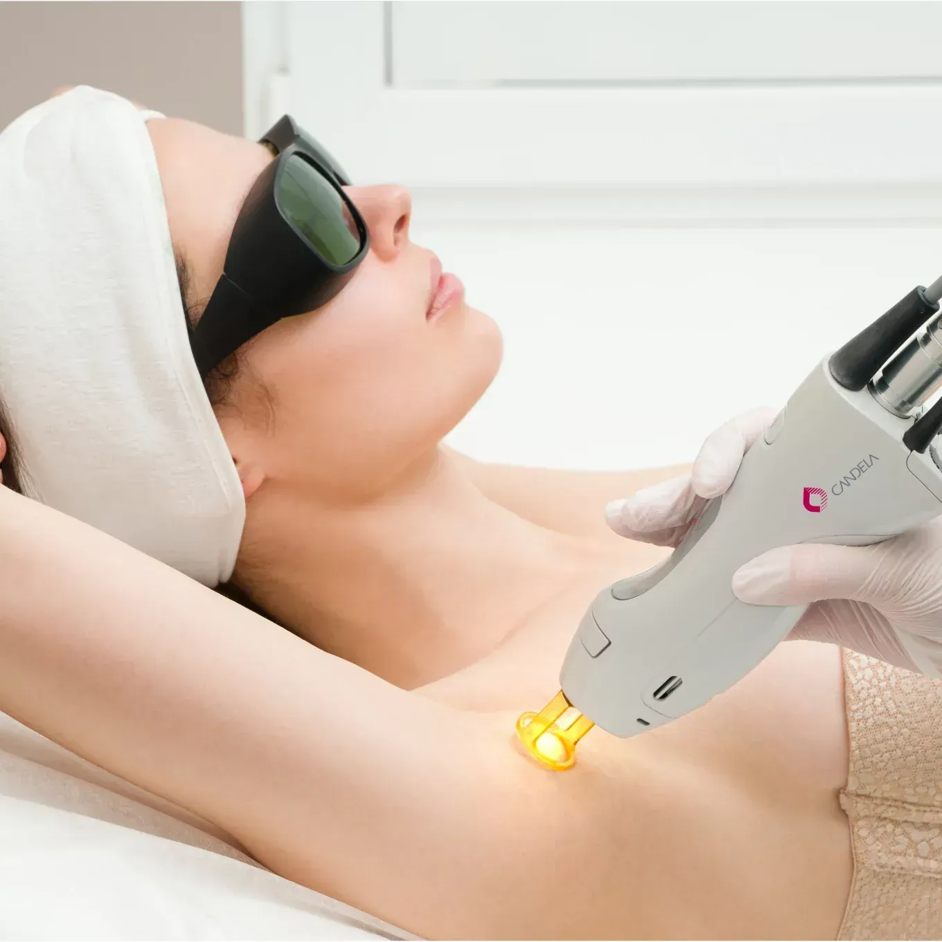 laser hair removal session