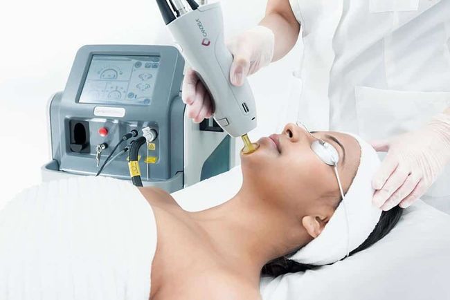 A woman is getting a laser treatment on her face.