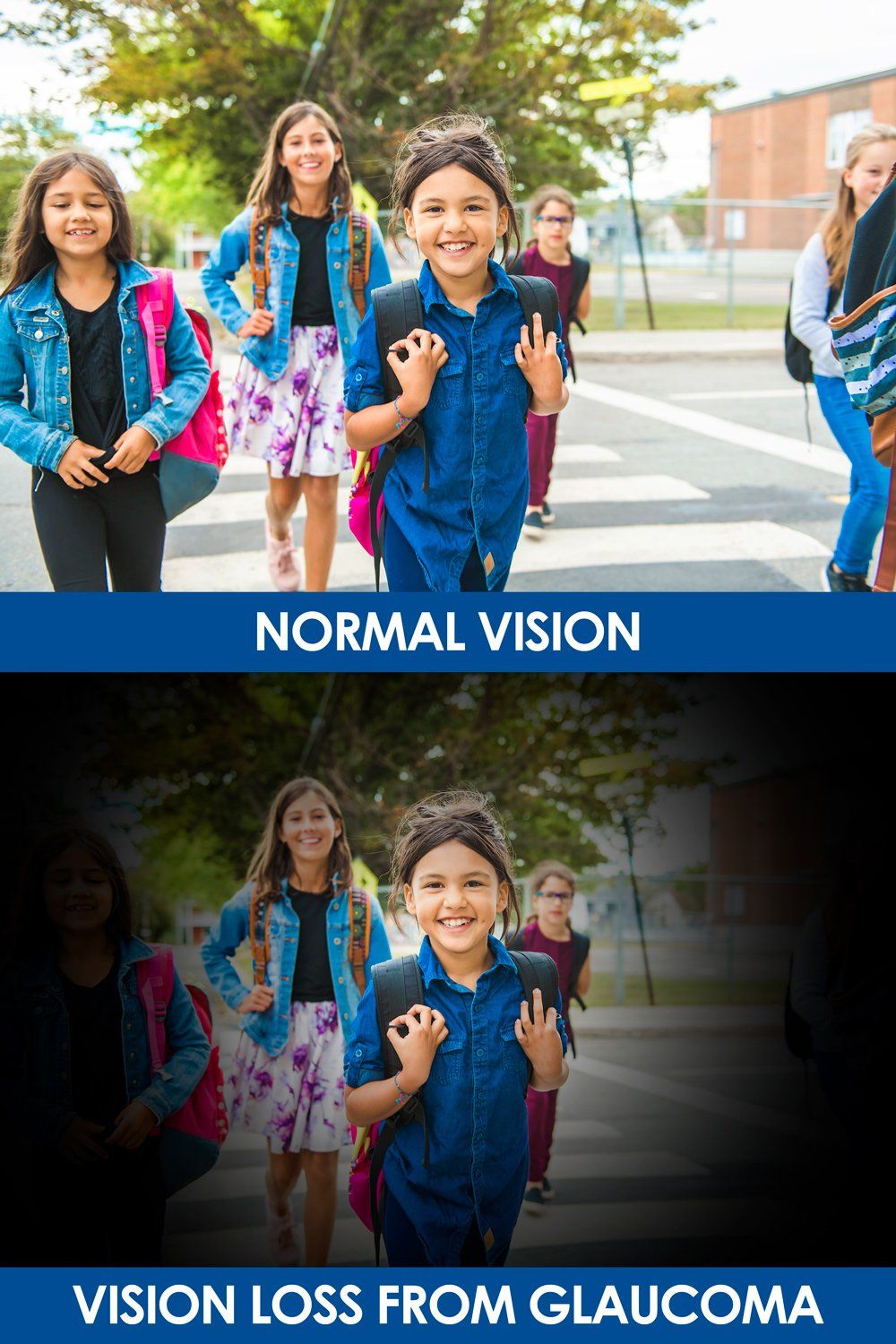 Glaucoma Vision Difference — Big Rapids, MI — Crew & Boss Eye Associates