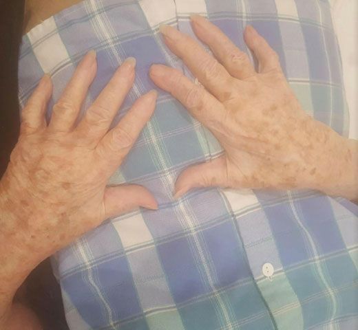 Two hands with visible sun spots resting on a blue and white plaid shirt.