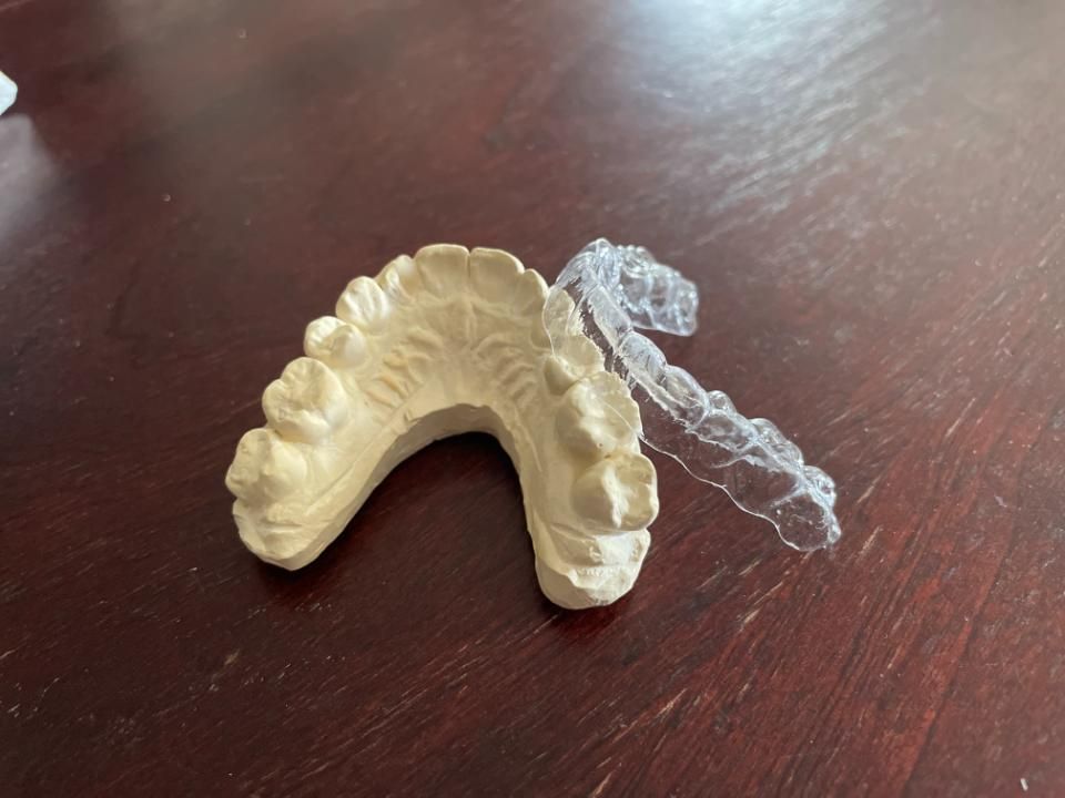 A model of a teeth and a clear brace on a wooden table