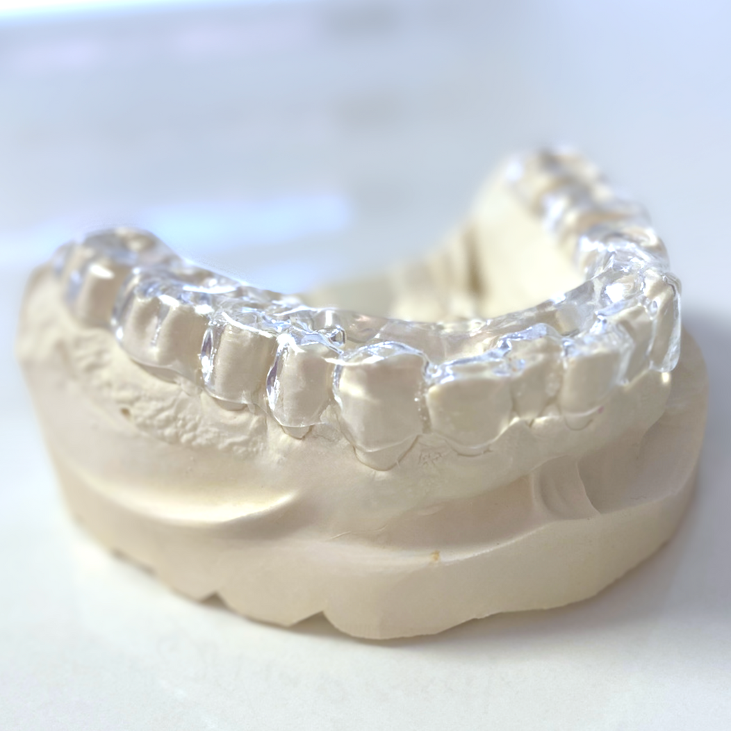 Detailaufnahme einer Zahnschiene für die Schienentherapie.