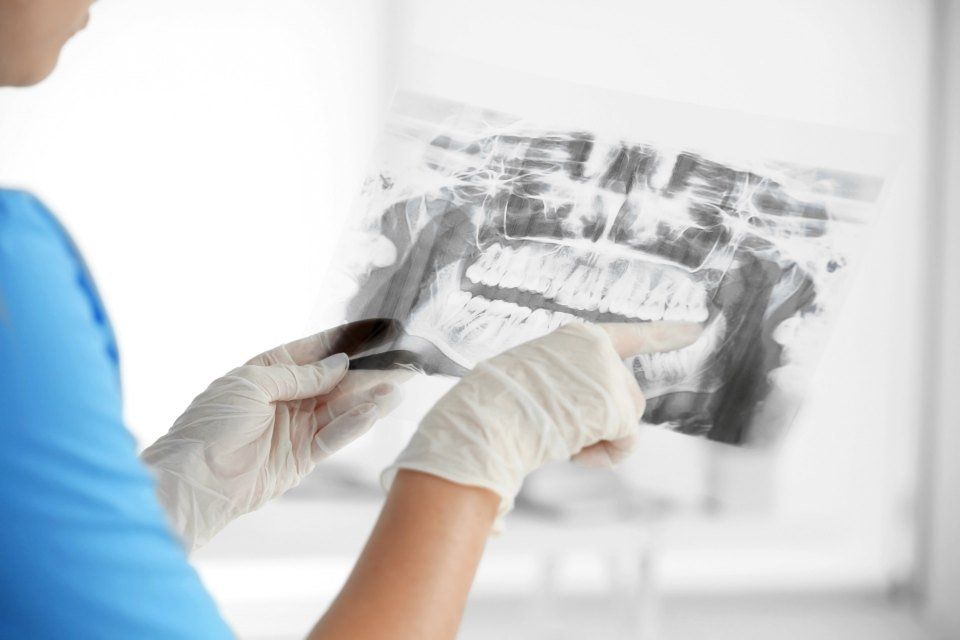 Chirurgia endodontica