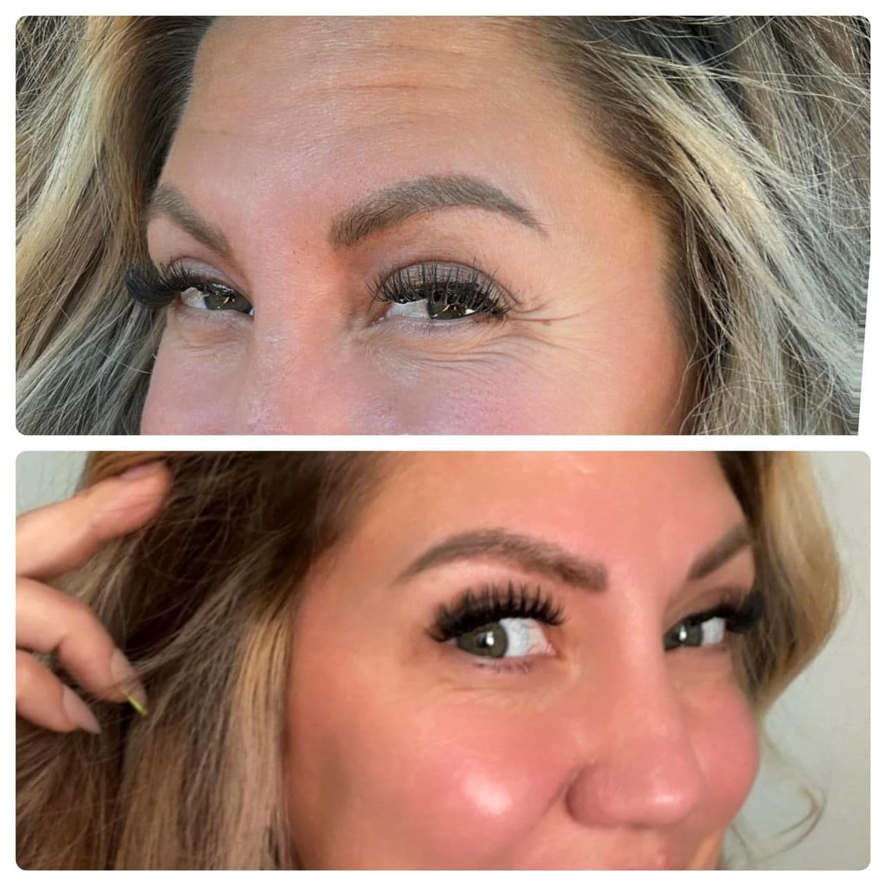 before and after botox springfield mo