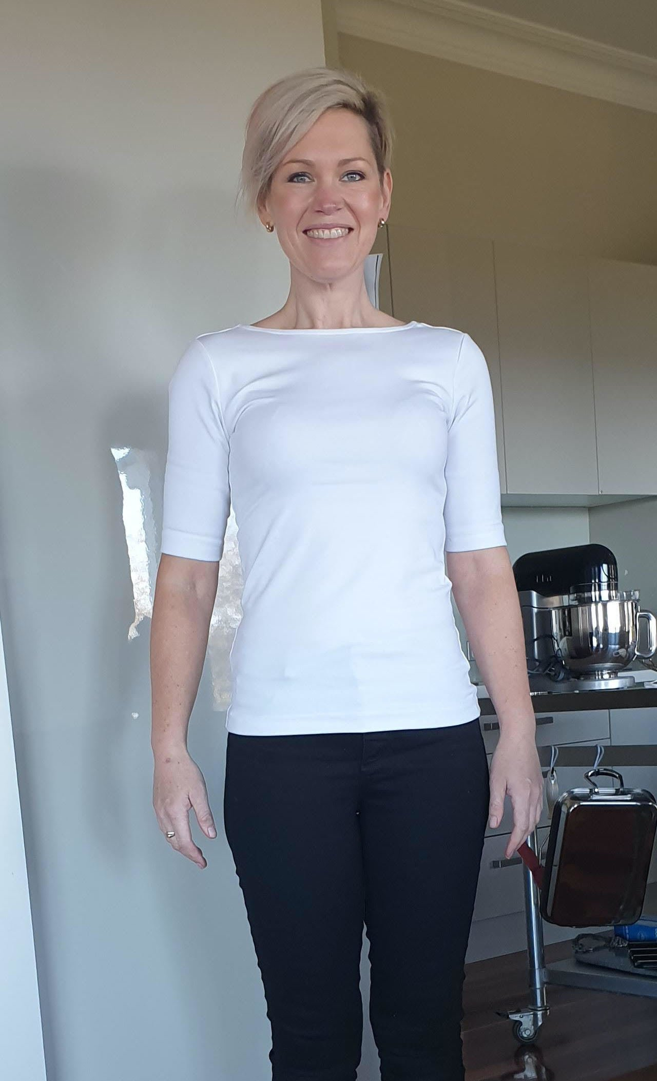 Before & After Weight Loss Surgery Sydney and Liverpool, NSW