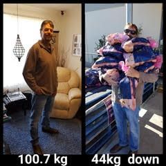 Patient Darren Before and After weight loss