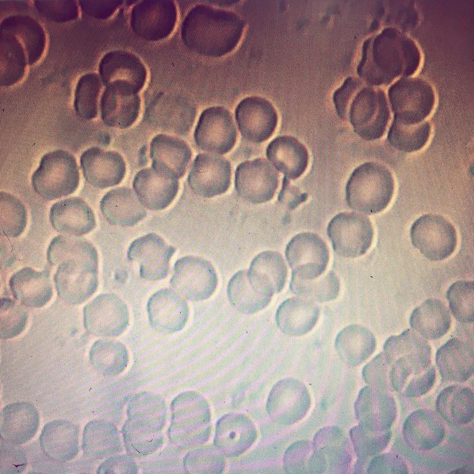 Live Blood Analysis Everything Naturopathic Fremantle