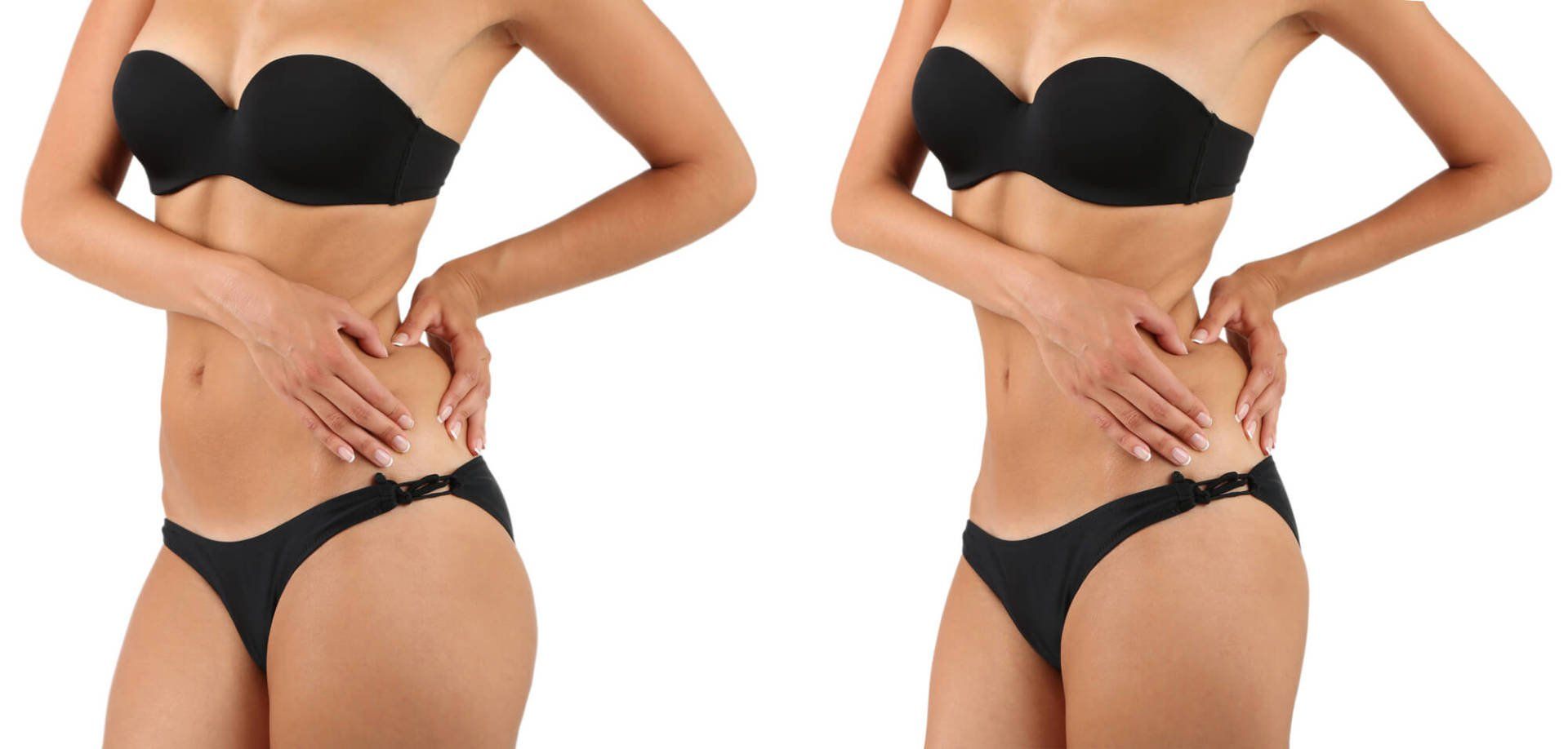 ultraschall kavitation bodyforming körperformung schlank bikinifigur silhouette