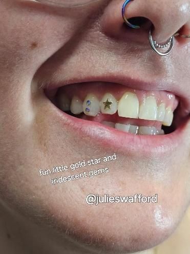 A close up of a person 's teeth with a nose ring.