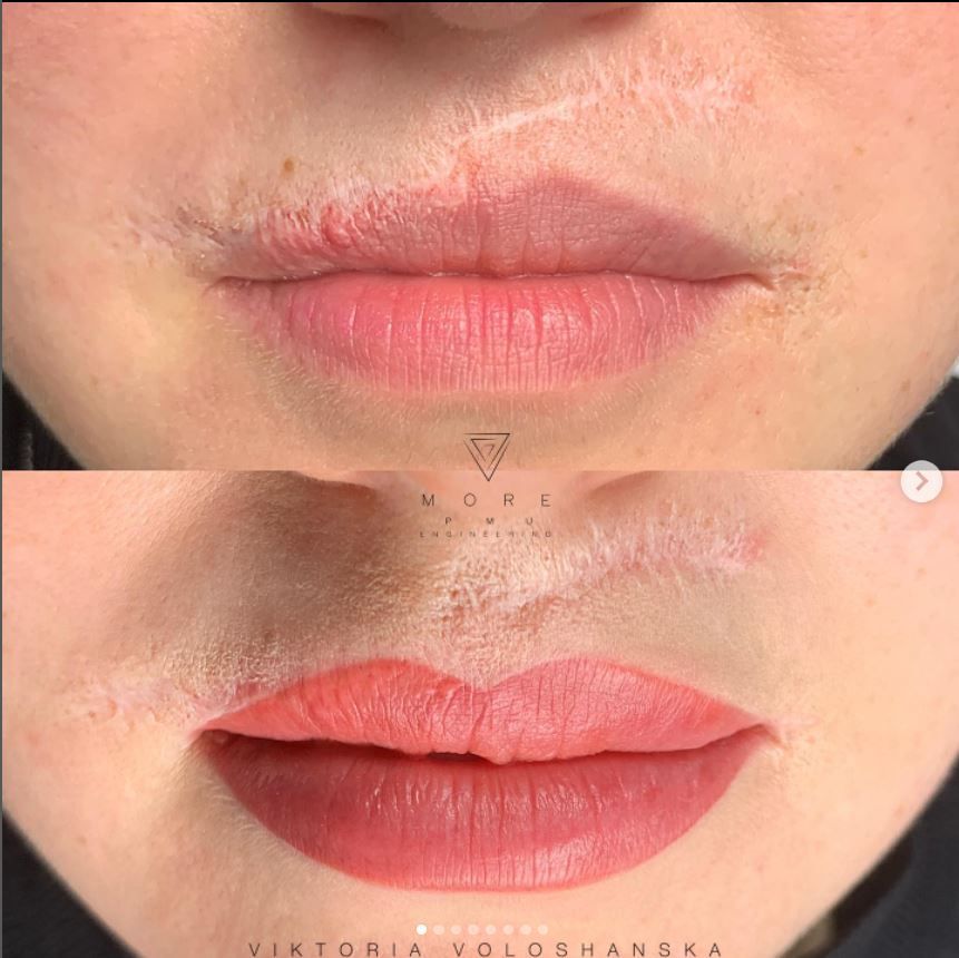 Primo piano delle labbra prima e dopo, con la matita per le labbra ben visibile e il rossetto più pieno e rosato nell'immagine in basso.