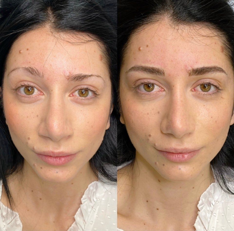 Clienti prima-dopo: tecnica di micropigmentazione sopracciglia