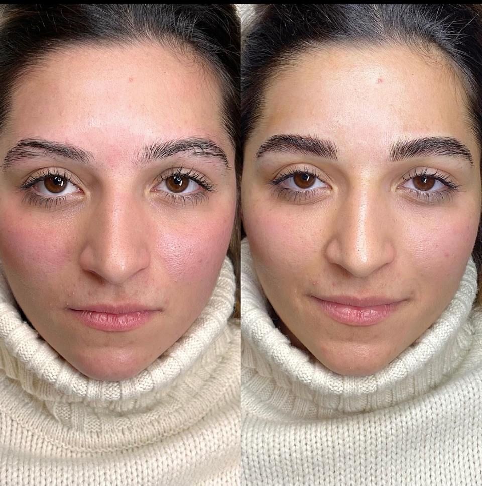 Clienti prima-dopo: tecnica di micropigmentazione sopracciglia