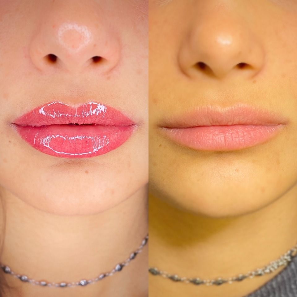 Clienti prima-dopo: tecnica Hybrid Lips
