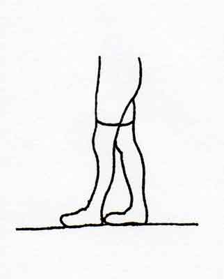 Idiopathic Toe Walking Treatment - Propel Physiotherapy