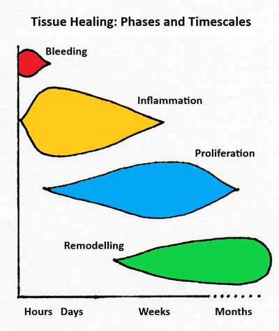 The Process Of Soft Tissue Repair: The Acute And Sub-Acute Phases