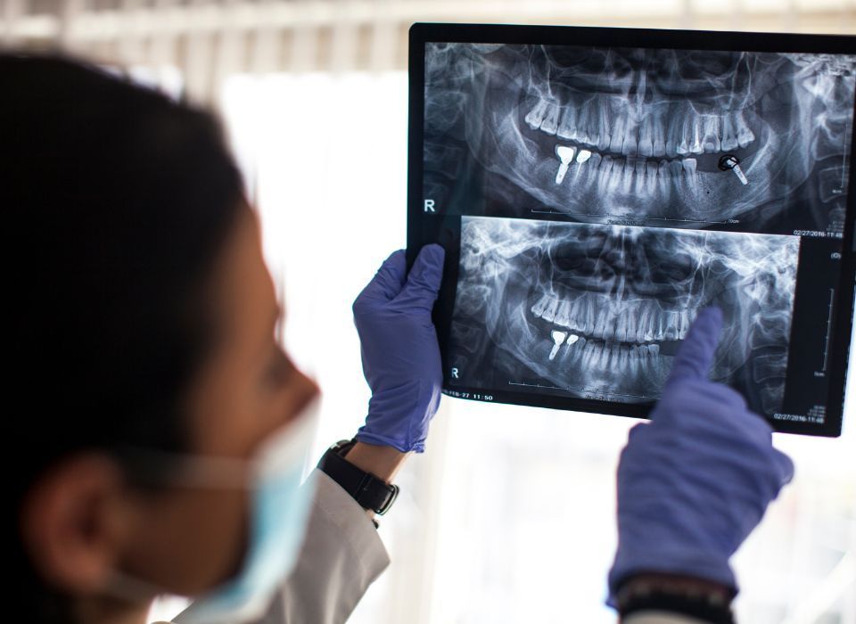 Dentist wearing gloves and mask examining dental X-ray.