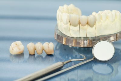 Crowns — Visual Of Dental Health Care in Henderson, NC