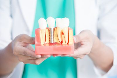 Implant — Woman Dentist Take Implant Tooth in Henderson, NC