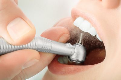 Cleaning — Closeup View Of Teeth Cleaning Process in Henderson, NC