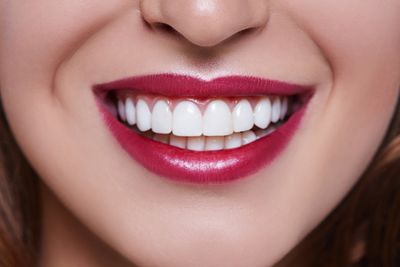 Veneers — Woman Smiling With Beautiful Teeth in Henderson, NC