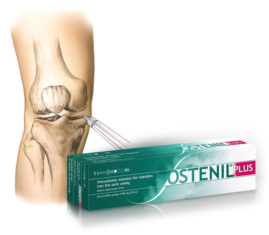 Ostenil plus -hyaluronic acid injection into knee joint to relieve pain 