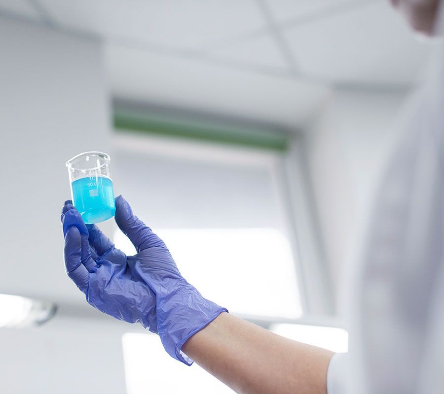 A gloved hand holds a small beaker filled with vibrant blue liquid in a clinical laboratory setting.