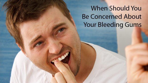 Bleeding Gums, Is it a Big Deal? When To Be Concerned About Bleeding Gums from Dr. Marichia Attalla, Leading Nassau County Periodontist