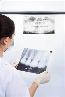 Periodontist looking at an xray for treatment for bone grafting in Nassau County.