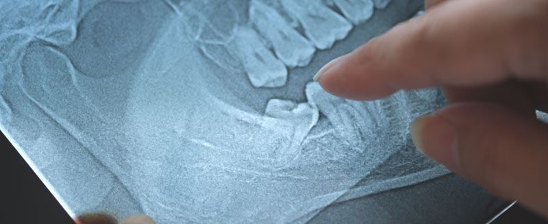 Holistic Dentistry by Dr. Stephanie Sfiroudis