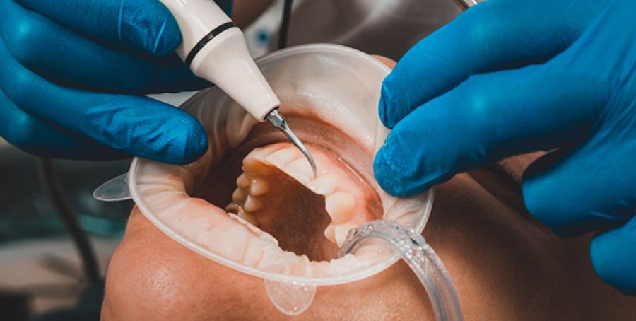 New Advances in Periodontal Treatment: Exploring Innovative Techniques Introduction
