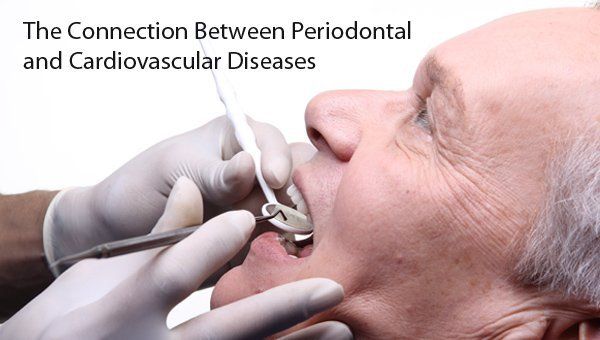 Periodontal and Cardiovascular Disease Connection