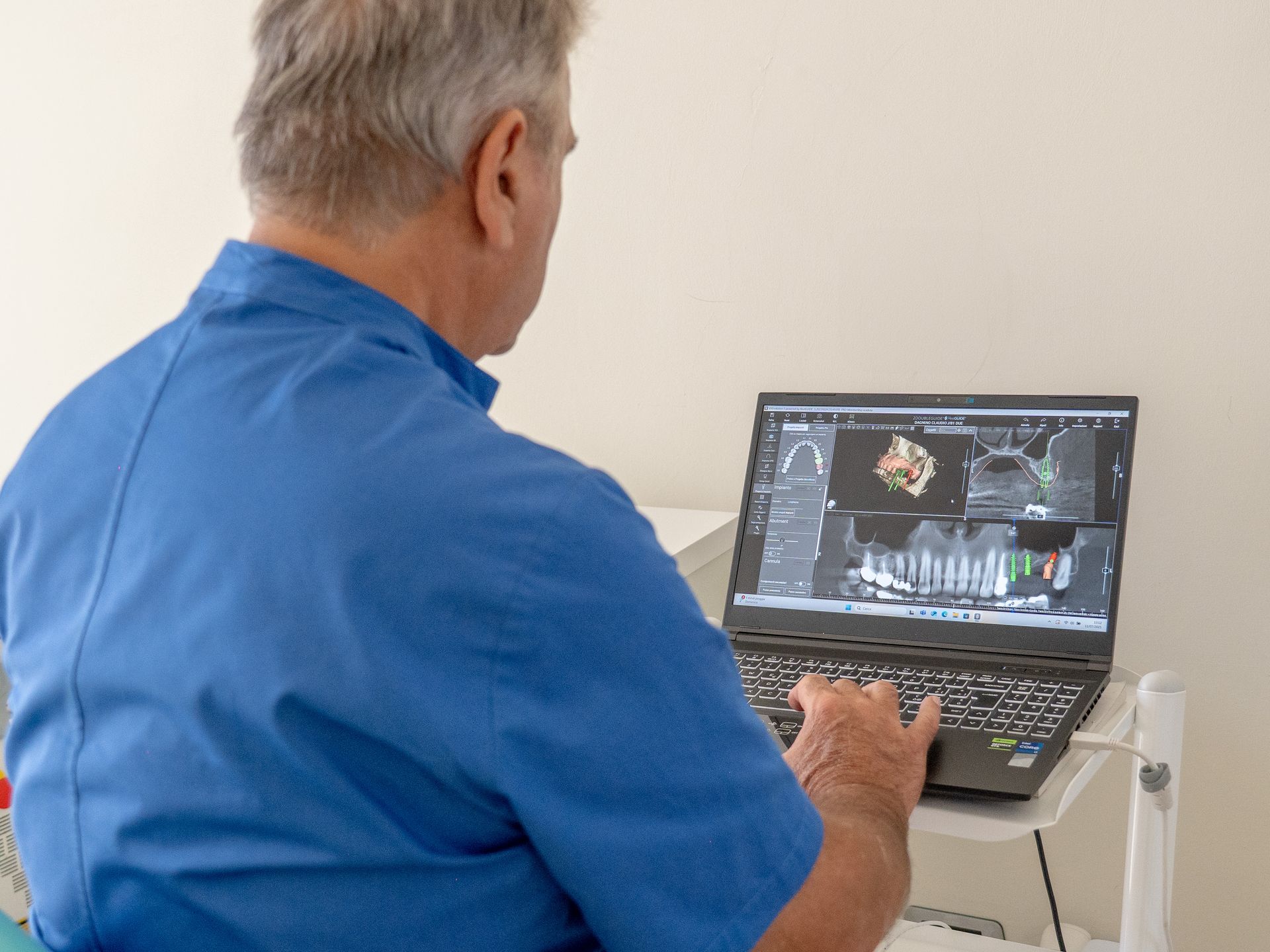 pianificazione implantare