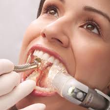 sistema di aspirazione rapida per dentisti