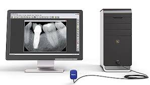 panoramica dentale digitale