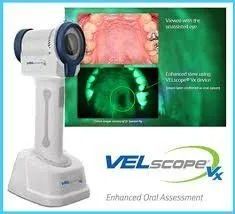Velscope per le lesioni sospette del cavo orale.