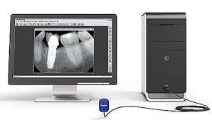 Radiografie endorali e panoramiche digitali