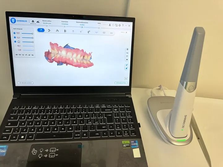 Impronte di precisione con camera intraorale