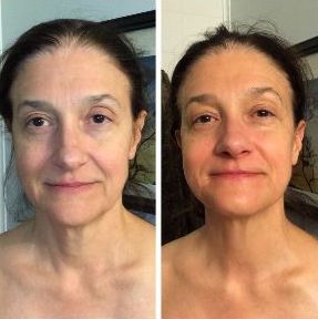 A before and after photo of a woman 's face.