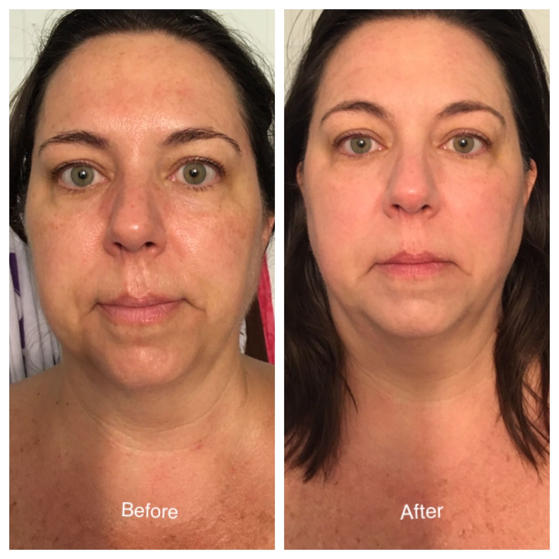 A before and after photo of a woman 's face.