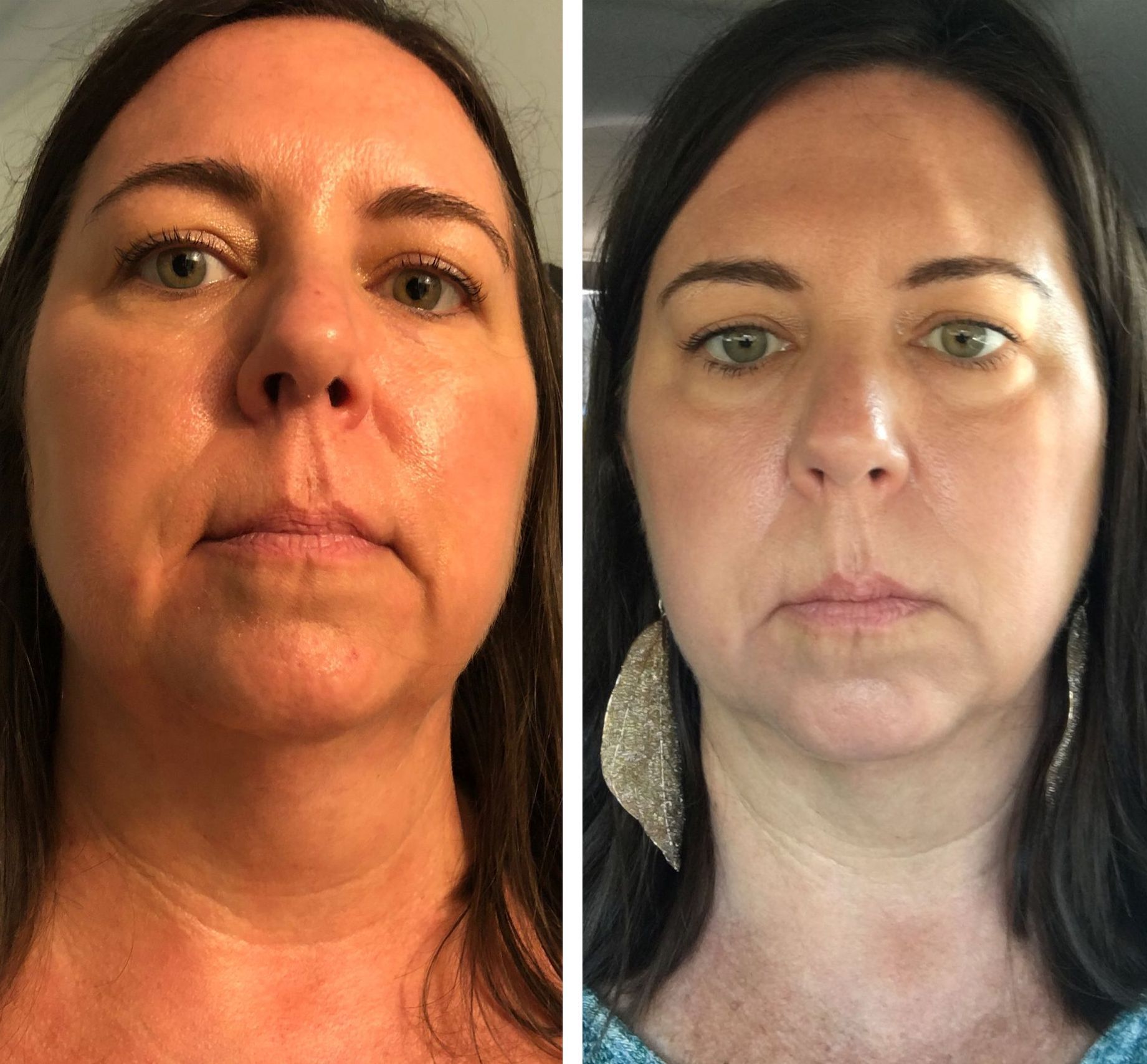 A before and after photo of a woman 's face