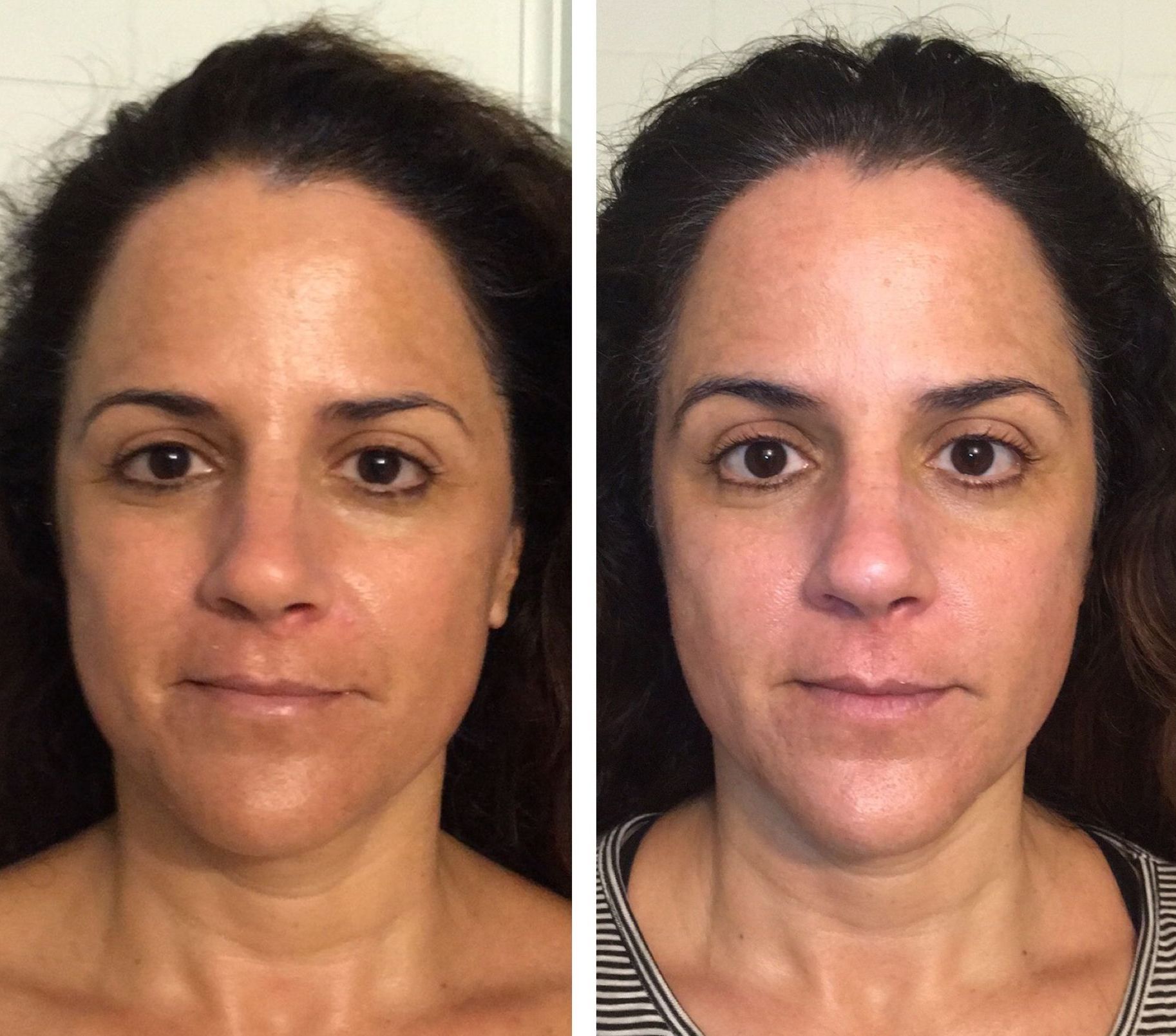 A before and after photo of a woman 's face.