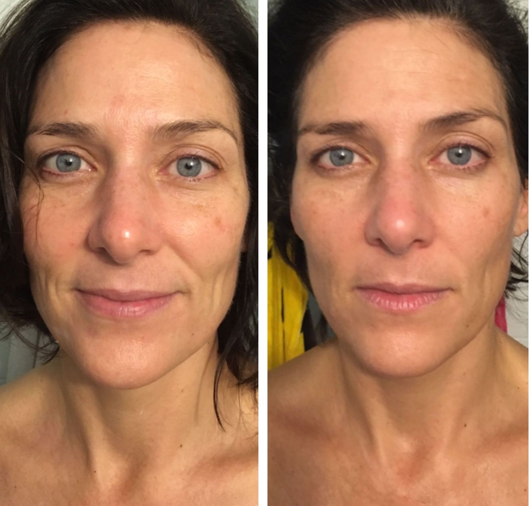 A before and after photo of a woman 's face.